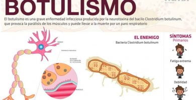 Clostridium botulinum